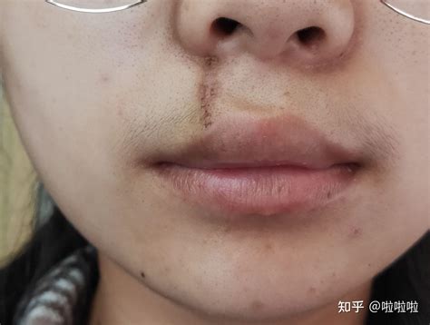 嘴角周围有痣的女人好不好_嘴角周围有痣的女人命怎么样,第6张 嘴角周围有痣的女人好不好_嘴角周围有痣的女人命怎么样,第6张